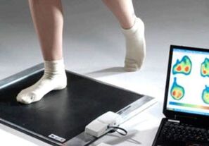 Hallux valgus diagnozė