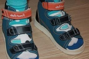 dėvėti sandalus nuo hallux valgus vaikui