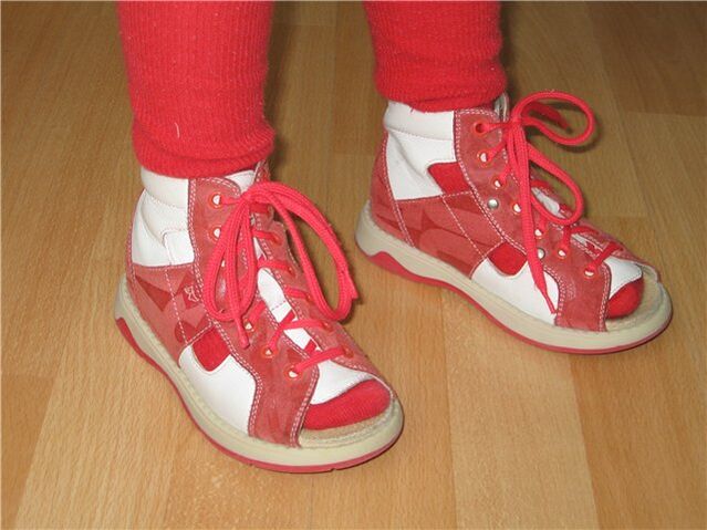 batai vaikams su hallux valgus