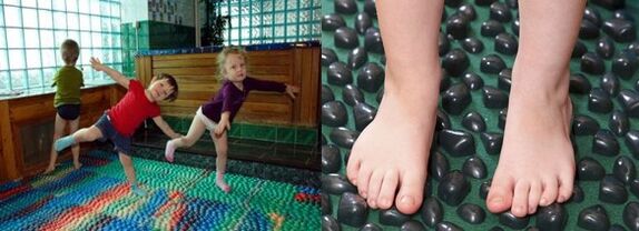 Gimnastika, skirta valgus deformacijai