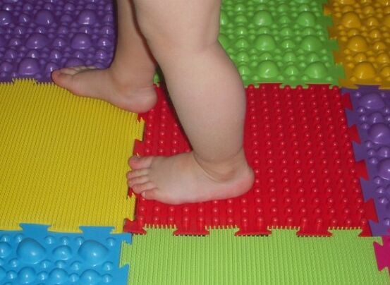 Valgus patologijos prevencija